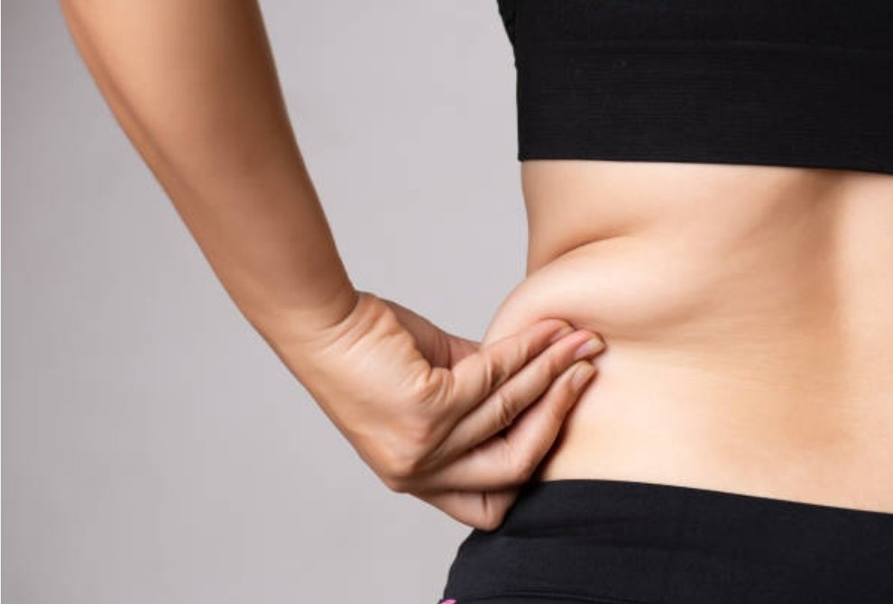 Séance de cryolipolyse à Bellissime Clinique Maubeuge